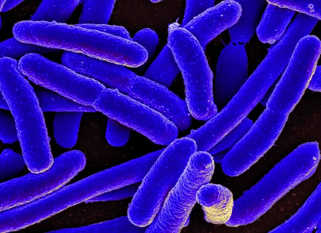 E. coli көбүнчө аялдарда циститтин өнүгүшүнө себеп болот